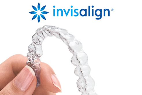 invisalign